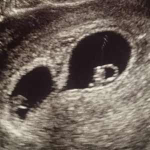 Meet your Posher, Miracle genesis blessing